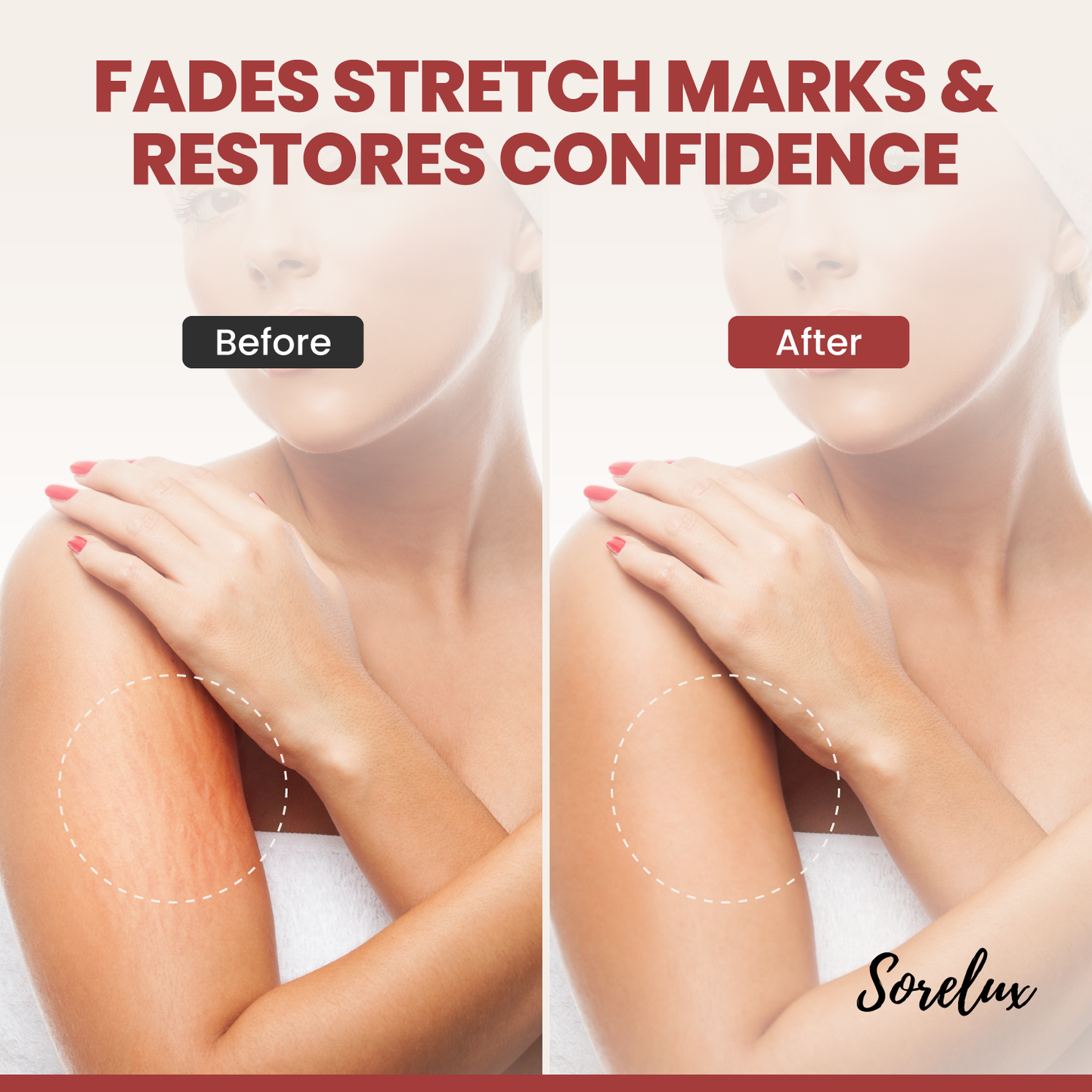 Sorelux Red Light Therapy Belt