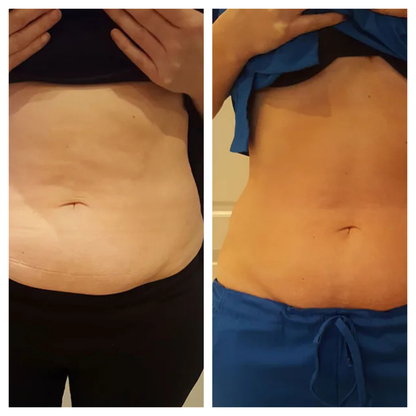 Sorelux Red Light Therapy Belt