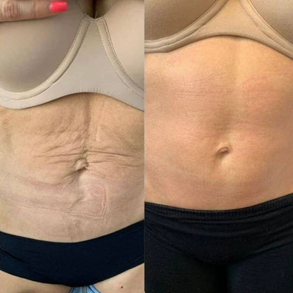 Sorelux Red Light Therapy Belt