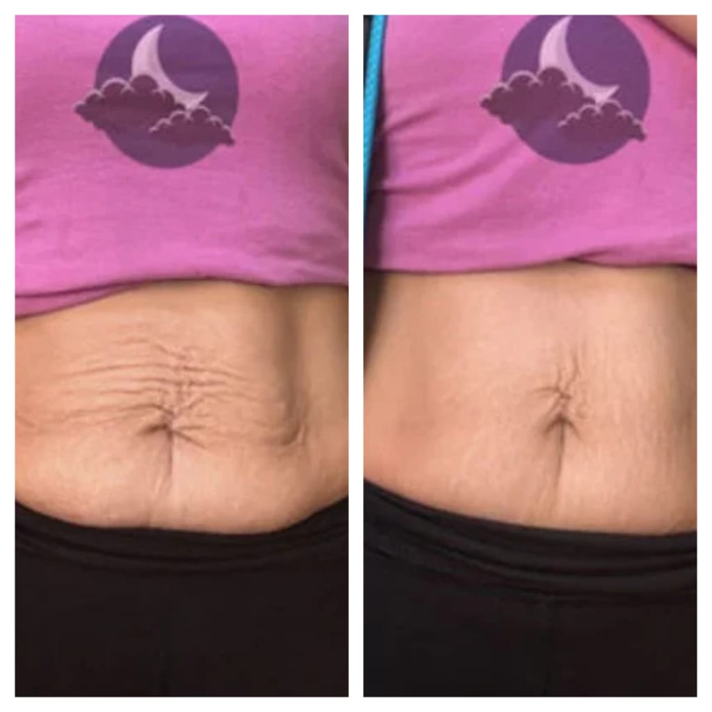 Sorelux Red Light Therapy Belt