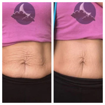 Sorelux Red Light Therapy Belt