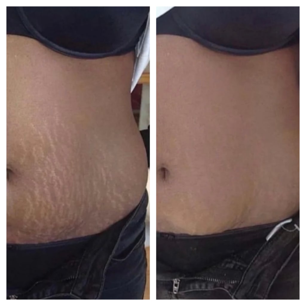 Sorelux Red Light Therapy Belt