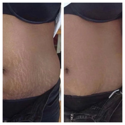 Sorelux Red Light Therapy Belt