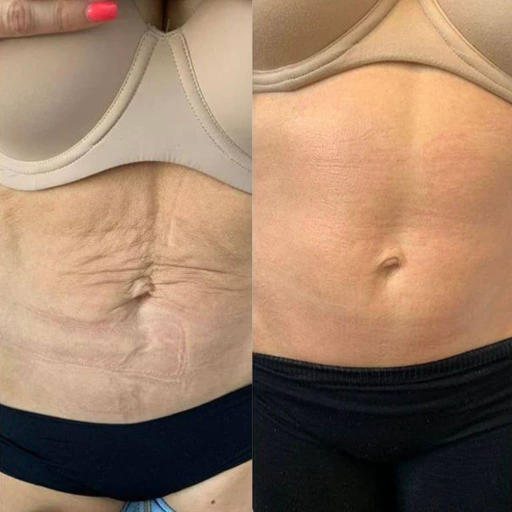 Sorelux Red Light Therapy Belt