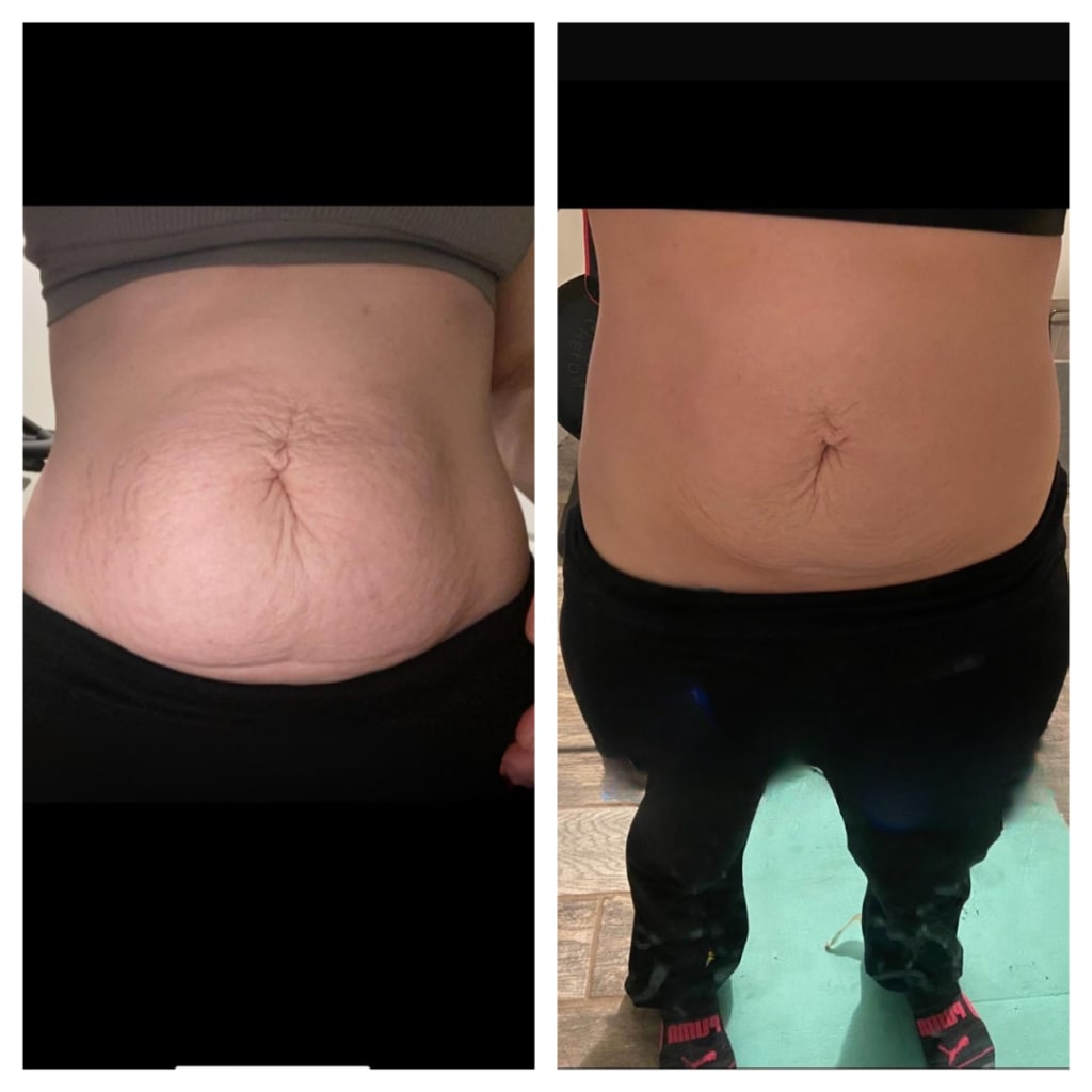 Sorelux Red Light Therapy Belt