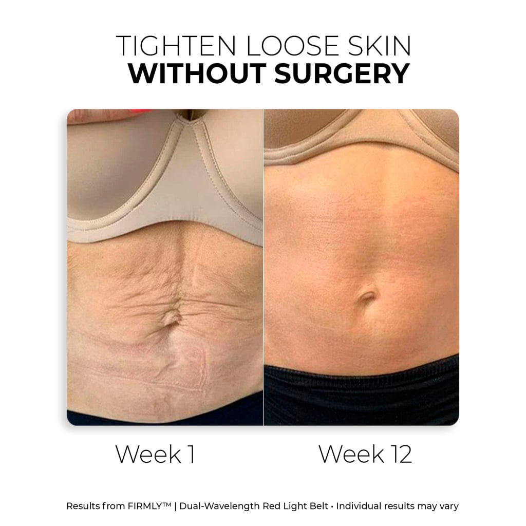 Sorelux Red Light Therapy Belt