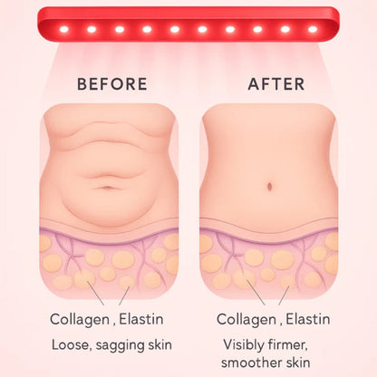 Sorelux Red Light Therapy Belt